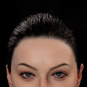 Implanted Artificial Hair